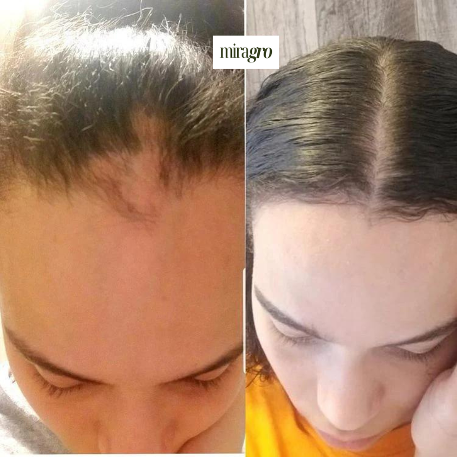 Edges Growth Cream - Buy One Get One FREE