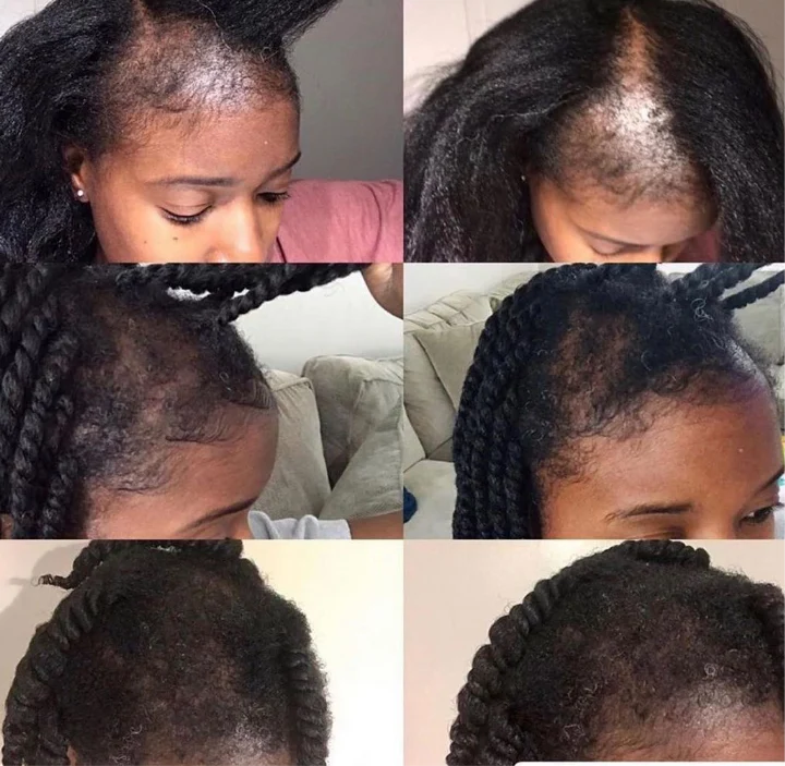 Edges Growth Cream - Buy One Get One FREE